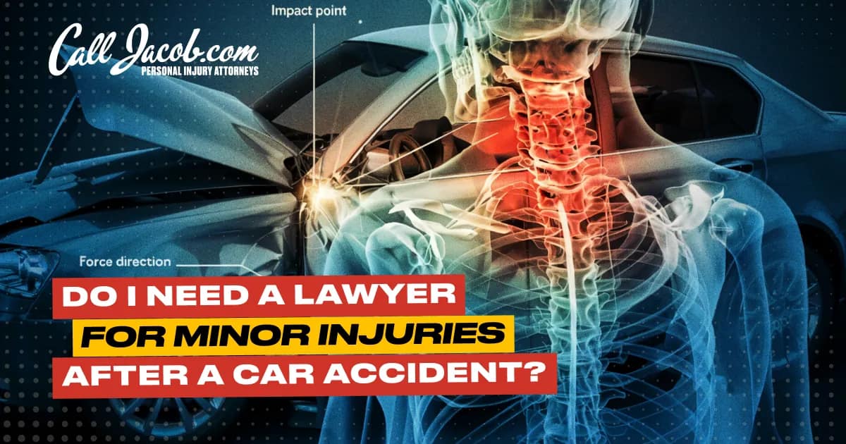 Lawyers for Minor Car Accident Injuries