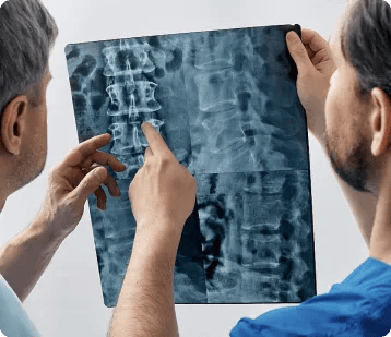 Two doctors examine an X-ray image of a spine. One points to a specific area, highlighting a possible injury—essential evidence often reviewed by personal injury attorneys in car accident cases.