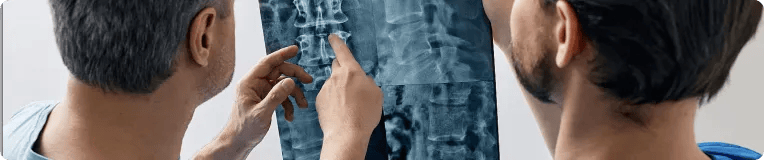 Two people examine a spinal X-ray; one points at a section of the spine while discussing the image, possibly in relation to a personal injury case with a personal injury attorney.