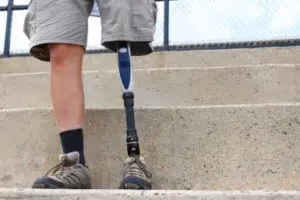 Una persona con pantalones cortos color caqui y zapatos de senderismo está de pie en escalones de concreto. Una pierna es natural y la otra es una extremidad protésica. Se puede ver una cerca de metal en el fondo.