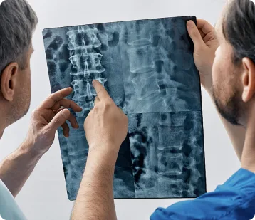 Two doctors examine an X-ray image of a spine. One points to a specific area, highlighting a possible injury—essential evidence often reviewed by personal injury attorneys in car accident cases.