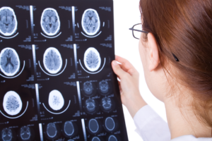 doctor analyzing brain scan images