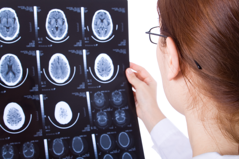 doctor analyzing brain scan images