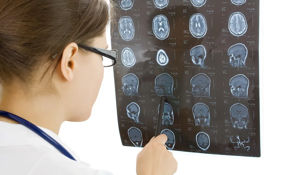 doctor examining a brain cat scan