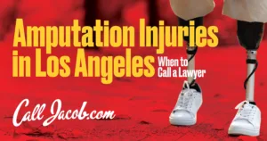Amputation Injuries in Los Angeles: When to Call a Lawyer
