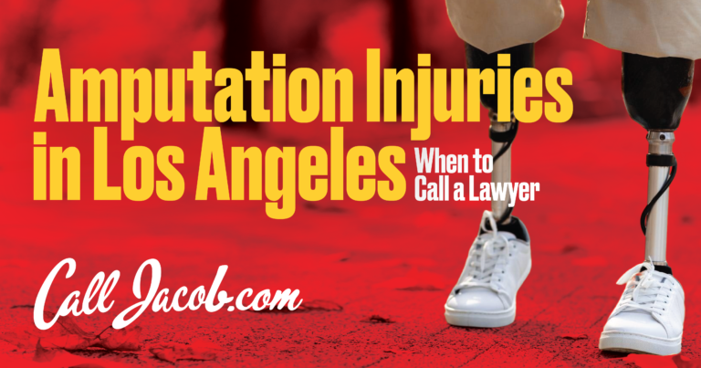 Amputation Injuries in Los Angeles: When to Call a Lawyer